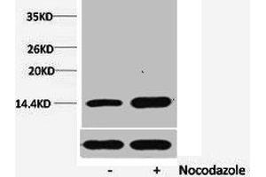 Western blot analysis of extracts from Hela cells, untreated (-) or treated, 1:5000. (HIST1H1A/HIST1H1C/HIST1H1D/HIST1H1E (pSer1) antibody)