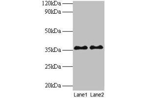 Western blot All lanes: SUPT3H antibody at 2 μg/mL Lane 1: Mouse brain tissue Lane 2: Colo320 whole cell lysate Secondary Goat polyclonal to rabbit IgG at 1/10000 dilution Predicted band size: 36, 38 kDa Observed band size: 36 kDa (SUPT3H/SPT3 antibody  (AA 1-328))