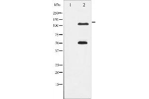 anti-Nuclear Factor of kappa Light Polypeptide Gene Enhancer in B-Cells 1 (NFKB1) (pSer337) antibody