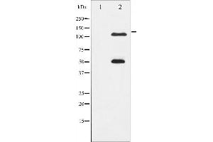 Western blot analysis of NF- kappaB p105/p50 phosphorylation expression in MDA-MB-435 whole cell lysates,The lane on the left is treated with the antigen-specific peptide. (NFKB1 antibody  (pSer337))