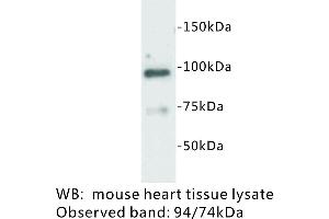 Image no. 1 for anti-Junctophilin 2 (JPH2) antibody (ABIN1112903) (Junctophilin 2 antibody)