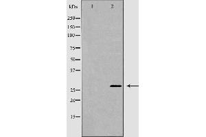 Western blot analysis of Hela whole cell lysates, using ARHGDIA Antibody.