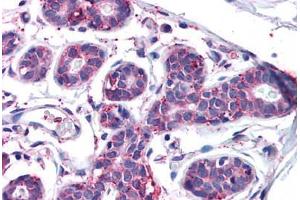 Human Breast: Formalin-Fixed, Paraffin-Embedded (FFPE) (MFI2 antibody  (N-Term))