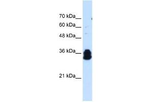 WB Suggested Anti-FAM134B Antibody Titration:  0. (FAM134B antibody  (Middle Region))