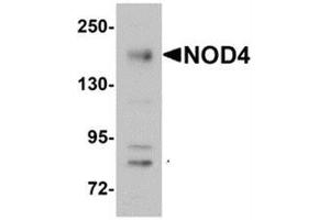 Western blot analysis of NOD4 in EL4 cell lysate with NOD4 antibody at 1 μg/ml.