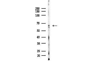 Western blot analysis of lysates from EC304 cells, using Phospho-SQSTM1/p62 (Ser349) Antibody at 1/1000 dilution.