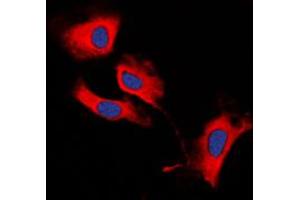 Immunofluorescent analysis of MMP13 staining in HeLa cells. (MMP13 antibody  (N-Term))