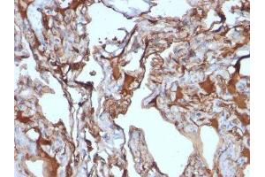 Image no. 2 for anti-Melanoma Cell Adhesion Molecule (MCAM) antibody (ABIN6153528)