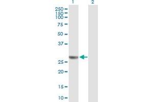 Western Blot analysis of NUDCD3 expression in transfected 293T cell line by NUDCD3 MaxPab polyclonal antibody. (NUDCD3 antibody  (AA 1-220))