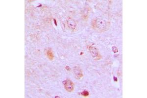 Immunohistochemical analysis of IARS2 staining in human brain formalin fixed paraffin embedded tissue section. (IARS2 antibody  (N-Term))