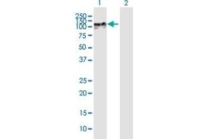 Western Blot analysis of ZNF710 expression in transfected 293T cell line by ZNF710 MaxPab polyclonal antibody. (ZNF710 antibody  (AA 1-664))