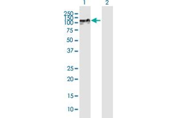 ZNF710 Antikörper  (AA 1-664)