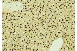 ABIN6277124 at 1/100 staining Mouse liver tissue by IHC-P. (NDRG1 antibody  (C-Term))