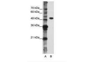 Image no. 1 for anti-DEAD (Asp-Glu-Ala-Asp) Box Polypeptide 47 (DDX47) (N-Term) antibody (ABIN6736231)