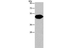 Western Blot analysis of Mouse brain tissue using PLIN2 Polyclonal Antibody at dilution of 1:680 (ADRP antibody)