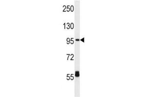 CPT1C antibody western blot analysis in HL-60 lysate. (CPT1C antibody  (AA 596-625))