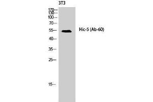 Western Blotting (WB) image for anti-Transforming Growth Factor beta 1 Induced Transcript 1 (TGFB1I1) (Tyr1586) antibody (ABIN3175482) (TGFB1I1 antibody  (Tyr1586))