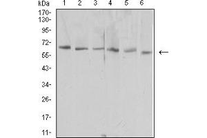 Western blot analysis using HAVCR1 mouse mAb against NIH/3T3 (1), HEK293 (2), Hela (3), Raw264. (HAVCR1 antibody  (AA 70-290))