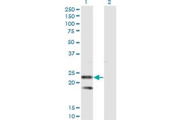 SSR2 antibody  (AA 51-150)