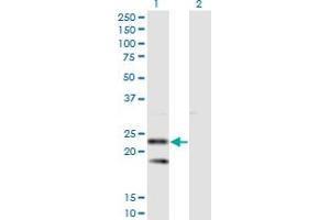Western Blot analysis of SSR2 expression in transfected 293T cell line by SSR2 monoclonal antibody (M01), clone 4C1. (SSR2 antibody  (AA 51-150))