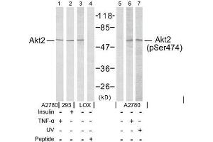 Image no. 2 for anti-V-Akt Murine Thymoma Viral Oncogene Homolog 2 (AKT2) (pSer474) antibody (ABIN196826) (AKT2 antibody  (pSer474))