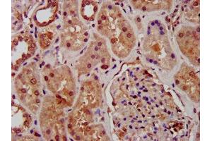 IHC image of ABIN7163811 diluted at 1:1000 and staining in paraffin-embedded human kidney tissue performed on a Leica BondTM system. (SUZ12 antibody  (AA 131-305))