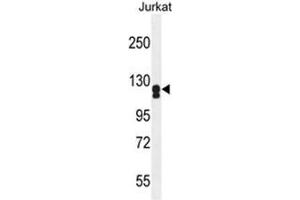 ADCY2 Antibody (Center) western blot analysis in Jurkat cell line lysates (35 µg/lane). (ADCY2 antibody  (Middle Region))