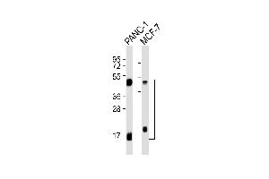 All lanes : Anti-Cathepsin D LC Antibody at 1:1000 dilution Lane 1: NC-1 whole cell lysates Lane 2: MCF-7 whole cell lysates Lysates/proteins at 20 μg per lane. (Cathepsin D antibody  (Light Chain))