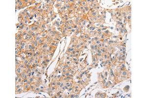 Immunohistochemistry (IHC) image for anti-ATP-Binding Cassette, Sub-Family C (CFTR/MRP), Member 1 (ABCC1) antibody (ABIN3017211) (ABCC1 antibody)