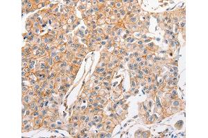 Immunohistochemistry (IHC) image for anti-ATP-Binding Cassette, Sub-Family C (CFTR/MRP), Member 1 (ABCC1) antibody (ABIN3017211) (ABCC1 antibody)