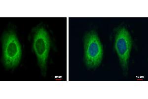 ICC/IF Image RAE1 antibody [C3], C-term detects RAE1 protein at cytoplasm by immunofluorescent analysis. (RAE1 antibody  (C-Term))