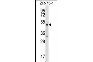 TBL2 Antibody (N-term) (ABIN656760 and ABIN2845981) western blot analysis in ZR-75-1 cell line lysates (35 μg/lane). (TBL2 antibody  (N-Term))