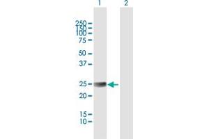 Western Blot analysis of ETHE1 expression in transfected 293T cell line by ETHE1 MaxPab polyclonal antibody. (ETHE1 antibody  (AA 1-254))