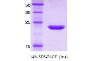 Figure annotation denotes ug of protein loaded and % gel used. (KIR2DS4 Protein)