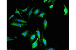 Immunofluorescent analysis of Hela cells using ABIN7149850 at dilution of 1:100 and Alexa Fluor 488-congugated AffiniPure Goat Anti-Rabbit IgG(H+L) (DGKZ antibody  (AA 11-152))