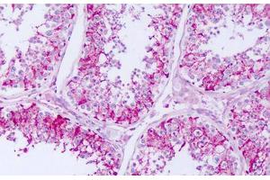 Image no. 1 for anti-Repetin (RPTN) (C-Term) antibody (ABIN6749795) (Repetin antibody  (C-Term))