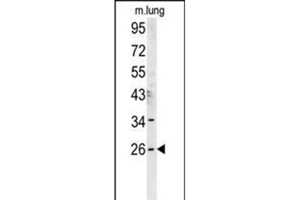DNAJC8 antibody  (C-Term)