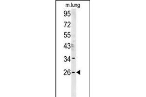 DNJC8 Antibody (C-term) (ABIN651765 and ABIN2840393) western blot analysis in mouse lung tissue lysates (15 μg/lane). (DNAJC8 antibody  (C-Term))