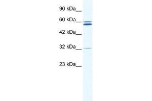 Western Blot showing ZNF491 antibody used at a concentration of 1-2 ug/ml to detect its target protein. (ZNF491 antibody  (N-Term))
