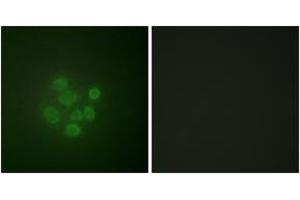 Immunofluorescence (IF) image for anti-Mdm2, p53 E3 Ubiquitin Protein Ligase Homolog (Mouse) (MDM2) (AA 132-181), (pSer166) antibody (ABIN1531340)