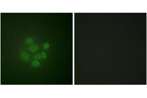 Immunofluorescence analysis of A549 cells, using MDM2 (Phospho-Ser166) Antibody. (MDM2 antibody  (pSer166))