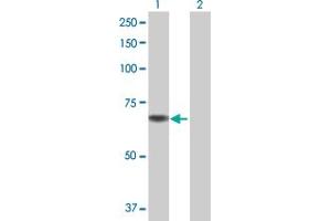 Western Blot analysis of CHDH expression in transfected 293T cell line by CHDH MaxPab polyclonal antibody. (CHDH antibody  (AA 1-594))