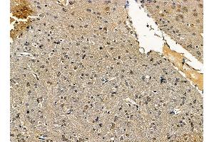 ABIN7095423 and ABIN7099480 at 1/100 staining rat brain tissue by IHC-P.