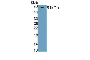 Detection of Recombinant COL1a2, Rabbit using Polyclonal Antibody to Collagen Type I Alpha 2 (COL1a2) (COL1A2 antibody)
