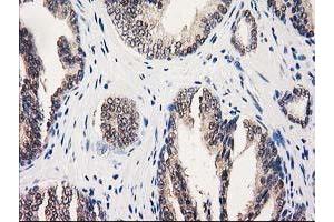 Image no. 10 for anti-UDP-Galactose-4-Epimerase (GALE) antibody (ABIN1498366)