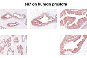Immunohistochemistry of KLK2 monoclonal antibody, clone 6B7  on formalin fixed paraffin embedded sections of human prostate. (Kallikrein 2 antibody)