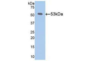 Western blot analysis of recombinant Mouse Klotho. (Klotho antibody  (AA 516-955))