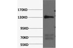 Western Blotting (WB) image for anti-Nitric Oxide Synthase 3 (Endothelial Cell) (NOS3) antibody (ABIN5961404) (ENOS antibody)