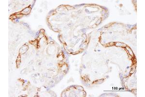 Immunohistochemistry (IHC) image for anti-Epidermal Growth Factor Receptor (EGFR) (AA 1100-1150) antibody (ABIN7454623) (EGFR antibody  (AA 1100-1150))