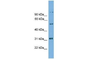 WB Suggested Anti-Irx2 Antibody Titration: 0.